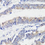Immunohistochemistry - Anti-CTNNB1 Antibody (A2064) - Antibodies.com