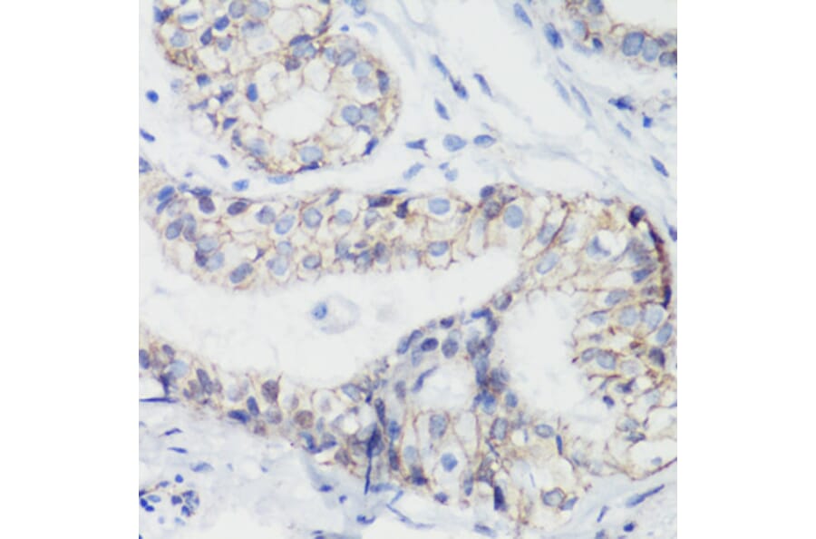 Immunohistochemistry - Anti-CTNNB1 Antibody (A2064) - Antibodies.com