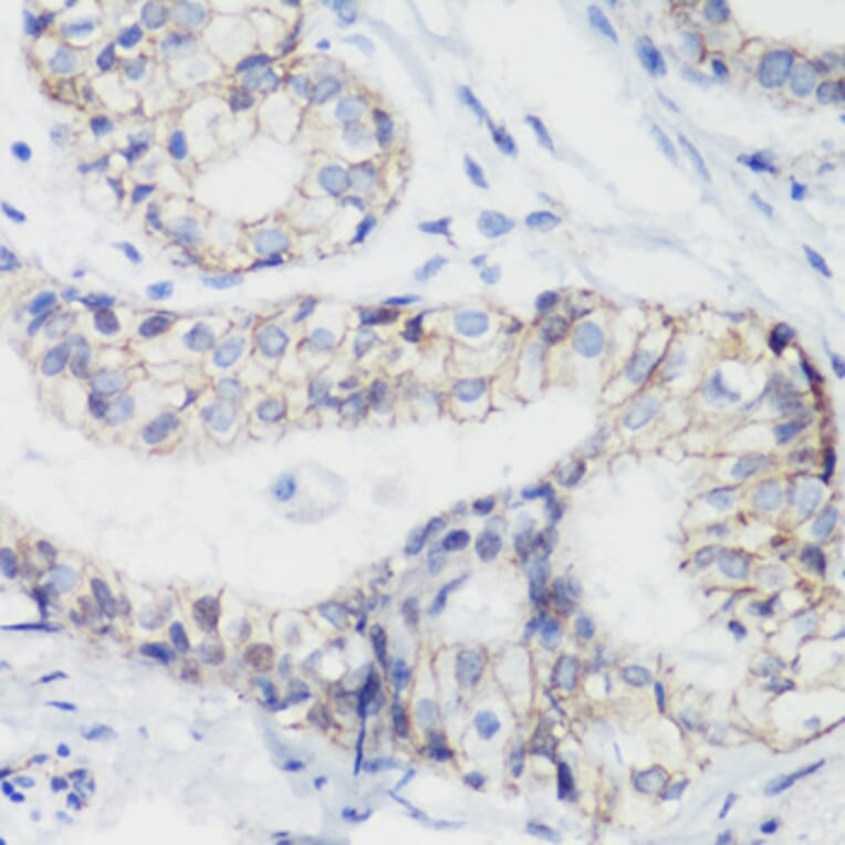 Immunohistochemistry - Anti-CTNNB1 Antibody (A2064) - Antibodies.com