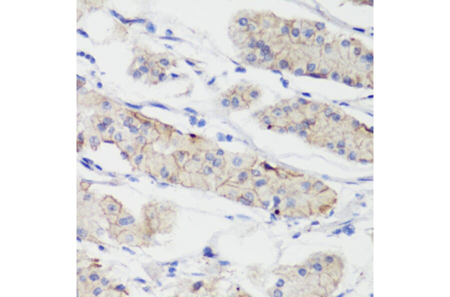 Immunohistochemistry - Anti-CTNNB1 Antibody (A2064) - Antibodies.com