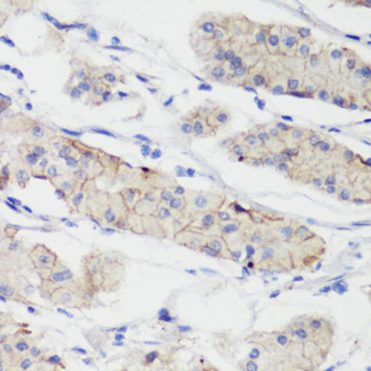 Immunohistochemistry - Anti-CTNNB1 Antibody (A2064) - Antibodies.com