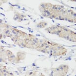 Immunohistochemistry - Anti-CTNNB1 Antibody (A2064) - Antibodies.com