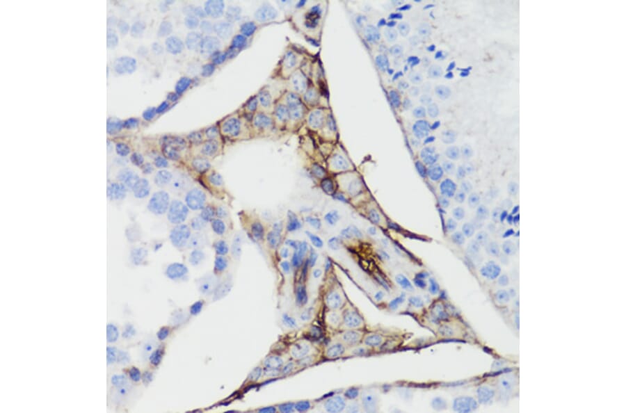 Immunohistochemistry - Anti-CTNNB1 Antibody (A2064) - Antibodies.com