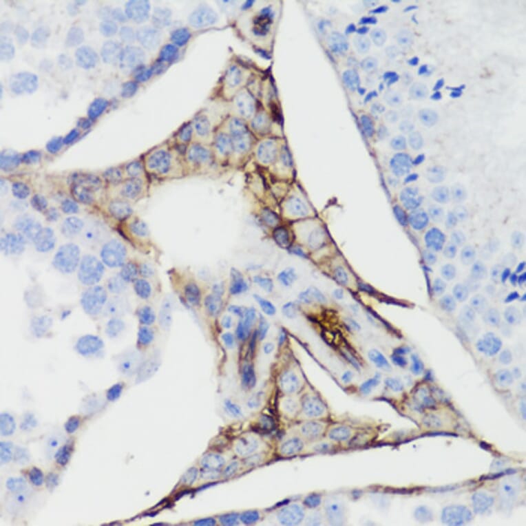 Immunohistochemistry - Anti-CTNNB1 Antibody (A2064) - Antibodies.com