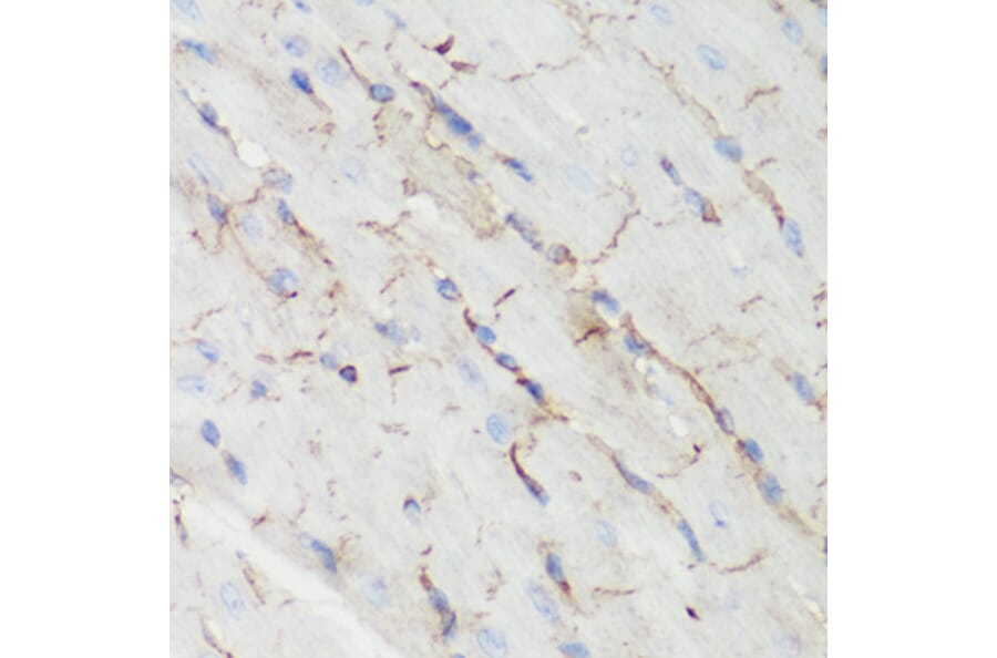 Immunohistochemistry - Anti-CTNNB1 Antibody (A2064) - Antibodies.com