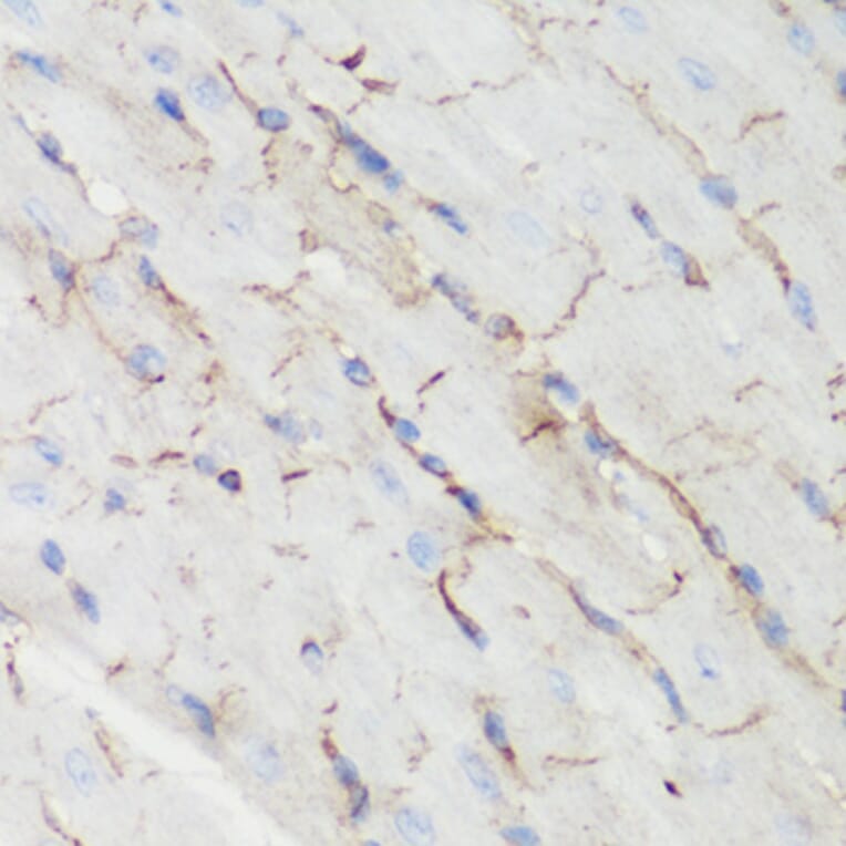 Immunohistochemistry - Anti-CTNNB1 Antibody (A2064) - Antibodies.com