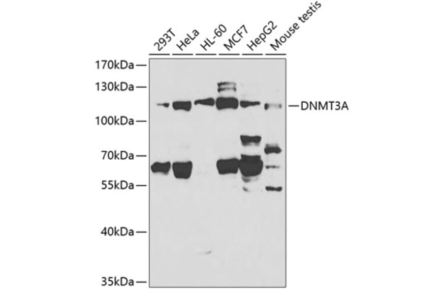 Western Blot - Anti-Dnmt3a Antibody (A13844) - Antibodies.com