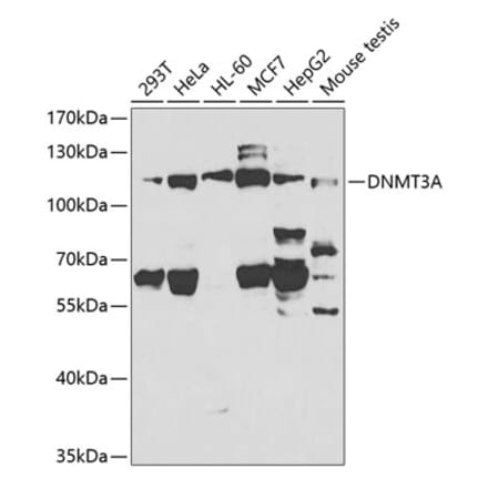 Western Blot - Anti-Dnmt3a Antibody (A13844) - Antibodies.com