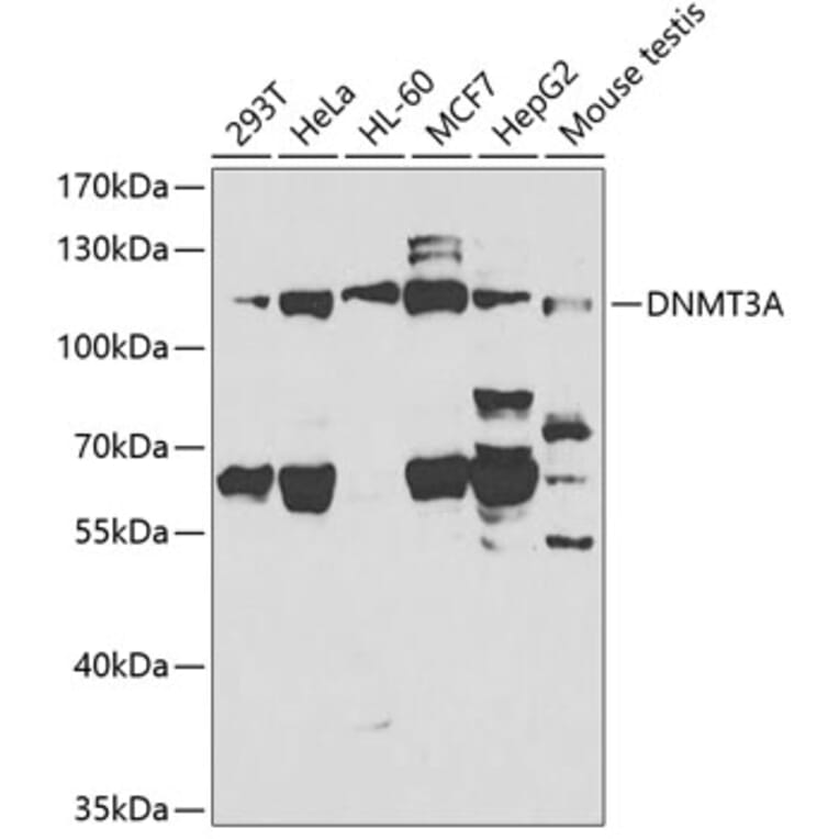 Western Blot - Anti-Dnmt3a Antibody (A13844) - Antibodies.com