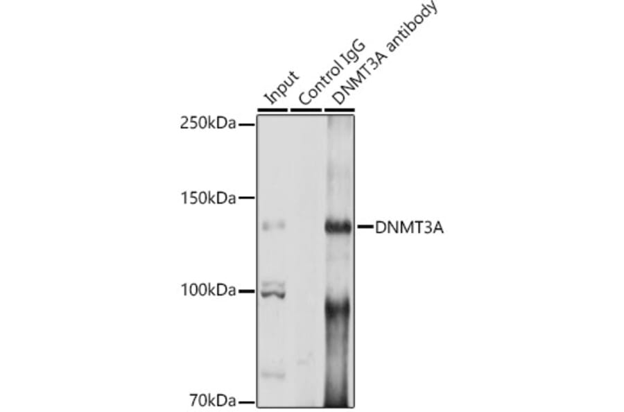 Western Blot - Anti-Dnmt3a Antibody (A13844) - Antibodies.com
