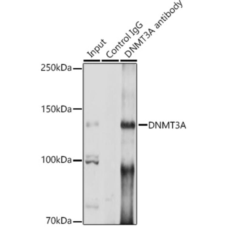 Western Blot - Anti-Dnmt3a Antibody (A13844) - Antibodies.com