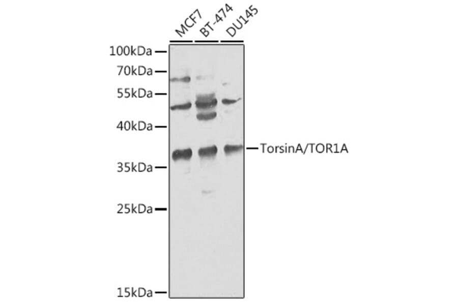 Western Blot - Anti-Torsin A/DYT1 Antibody (A13845) - Antibodies.com