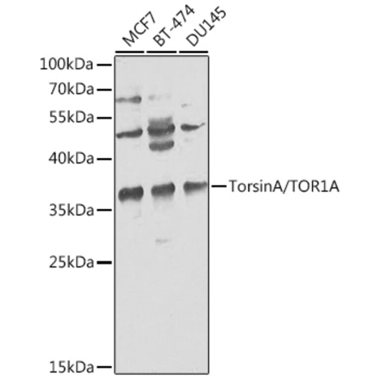 Western Blot - Anti-Torsin A/DYT1 Antibody (A13845) - Antibodies.com