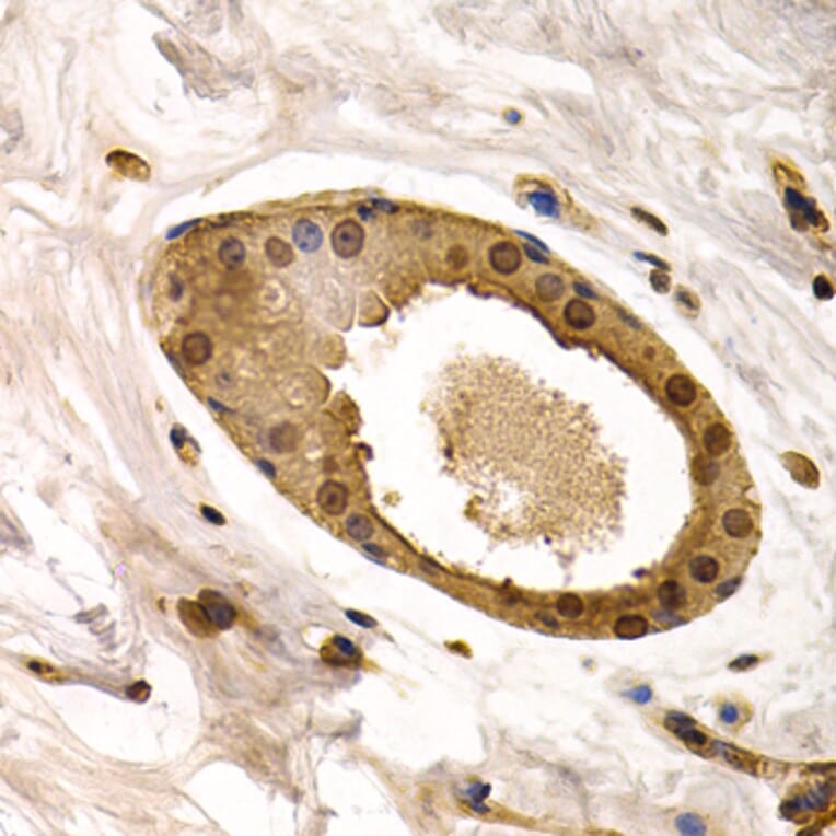 Immunohistochemistry - Anti-Torsin A/DYT1 Antibody (A13845) - Antibodies.com