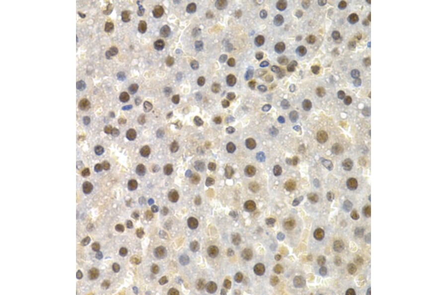 Immunohistochemistry - Anti-Torsin A/DYT1 Antibody (A13845) - Antibodies.com
