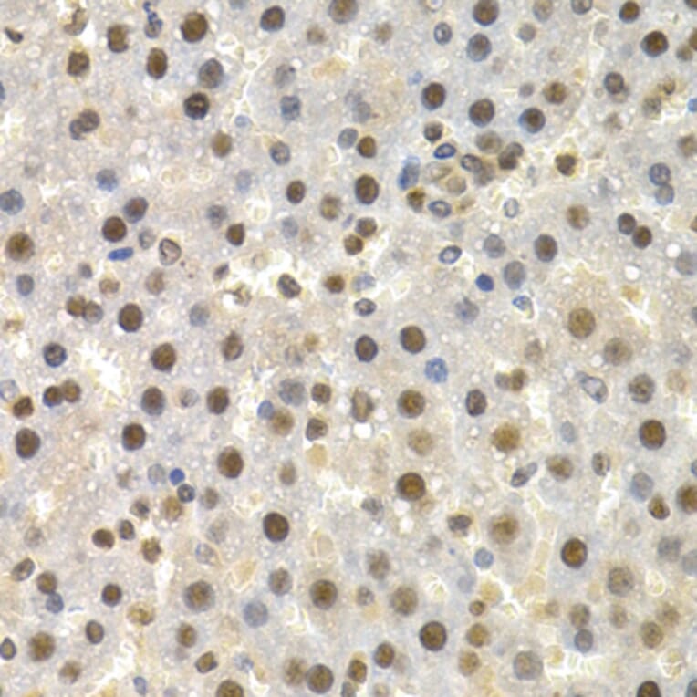 Immunohistochemistry - Anti-Torsin A/DYT1 Antibody (A13845) - Antibodies.com