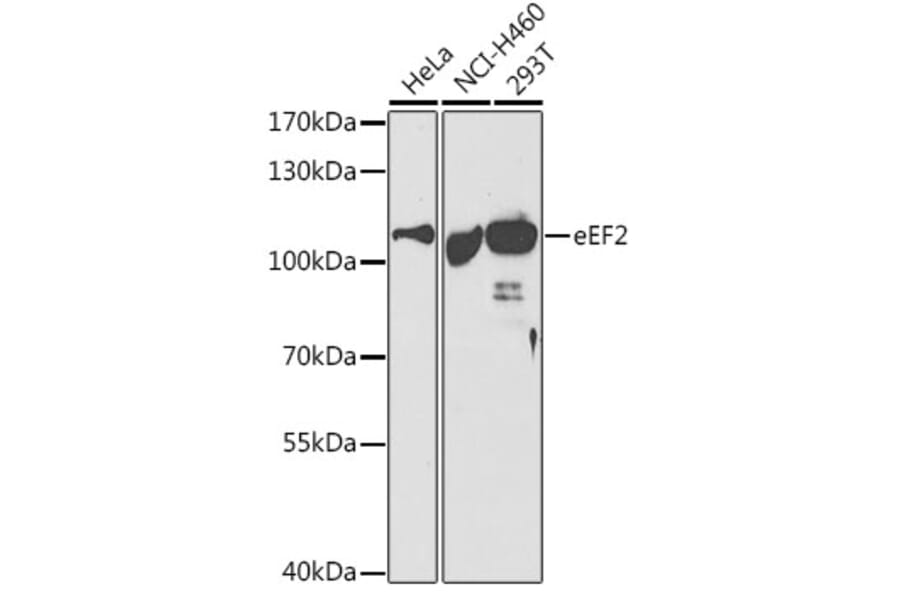 Western Blot - Anti-EEF2/Elongation factor 2 Antibody (A13846) - Antibodies.com