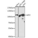 Western Blot - Anti-EEF2/Elongation factor 2 Antibody (A13846) - Antibodies.com
