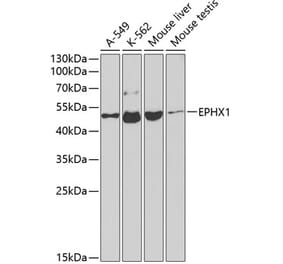 Western Blot - Anti-Epoxide hydrolase Antibody (A13847) - Antibodies.com