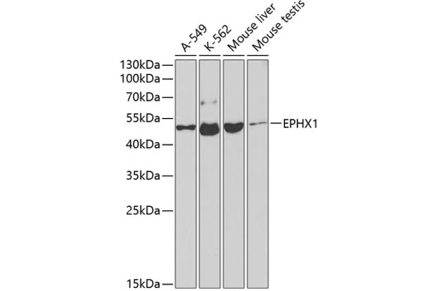 Western Blot - Anti-Epoxide hydrolase Antibody (A13847) - Antibodies.com