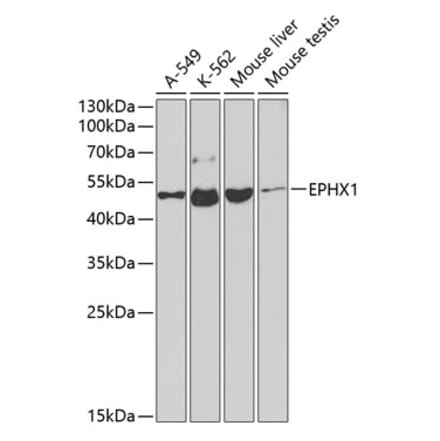 Western Blot - Anti-Epoxide hydrolase Antibody (A13847) - Antibodies.com