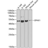 Western Blot - Anti-Epoxide hydrolase Antibody (A13847) - Antibodies.com