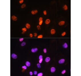 Immunofluorescence - Anti-FANCD2 Antibody (A13848) - Antibodies.com