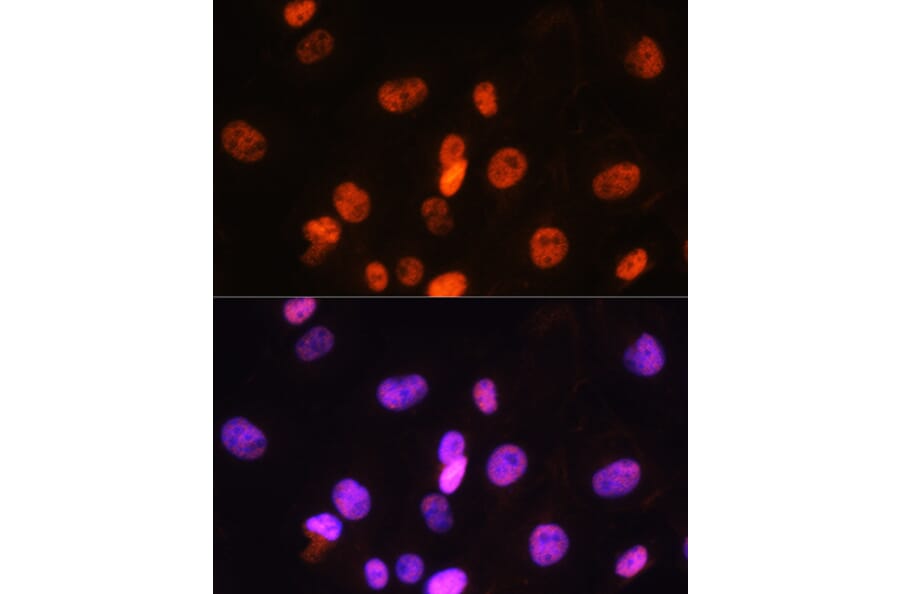 Immunofluorescence - Anti-FANCD2 Antibody (A13848) - Antibodies.com