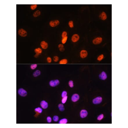 Immunofluorescence - Anti-FANCD2 Antibody (A13848) - Antibodies.com