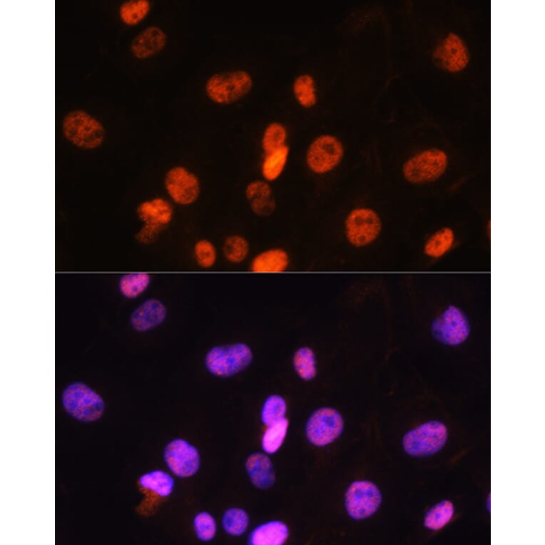 Immunofluorescence - Anti-FANCD2 Antibody (A13848) - Antibodies.com
