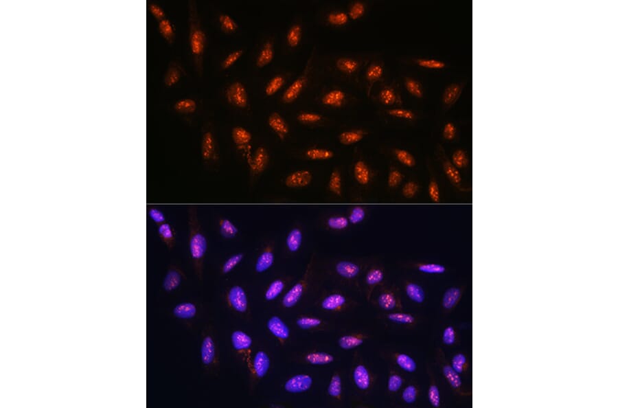 Immunofluorescence - Anti-FANCD2 Antibody (A13848) - Antibodies.com