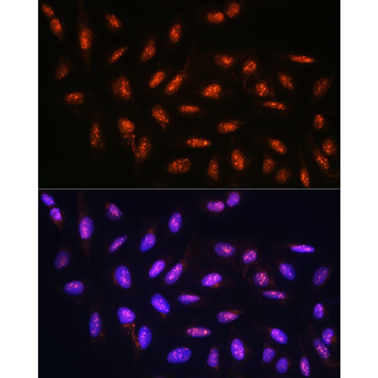 Immunofluorescence - Anti-FANCD2 Antibody (A13848) - Antibodies.com