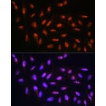 Immunofluorescence - Anti-FANCD2 Antibody (A13848) - Antibodies.com