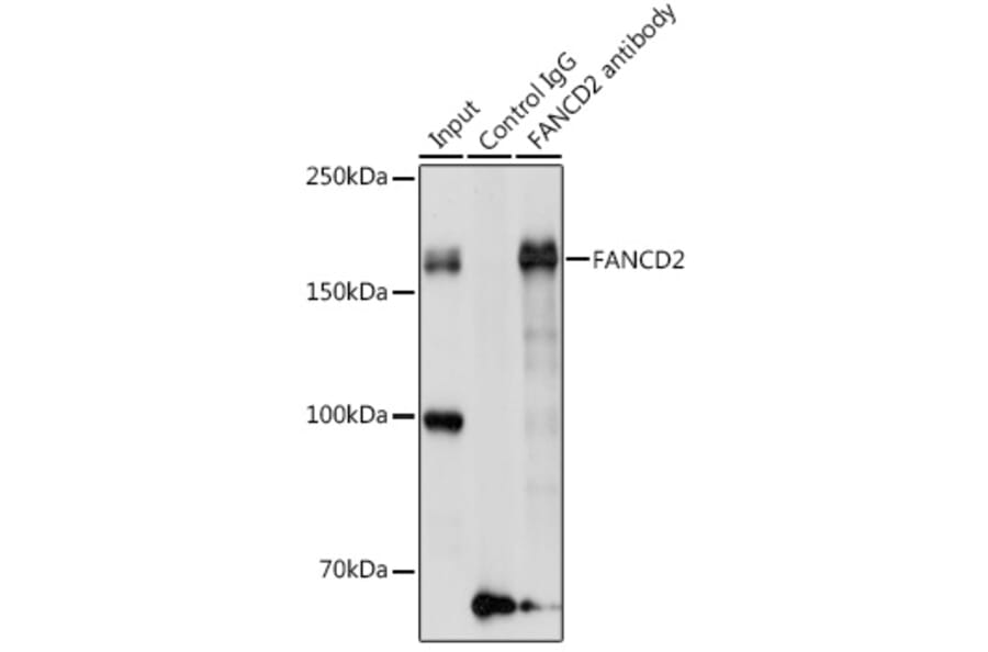 Western Blot - Anti-FANCD2 Antibody (A13848) - Antibodies.com
