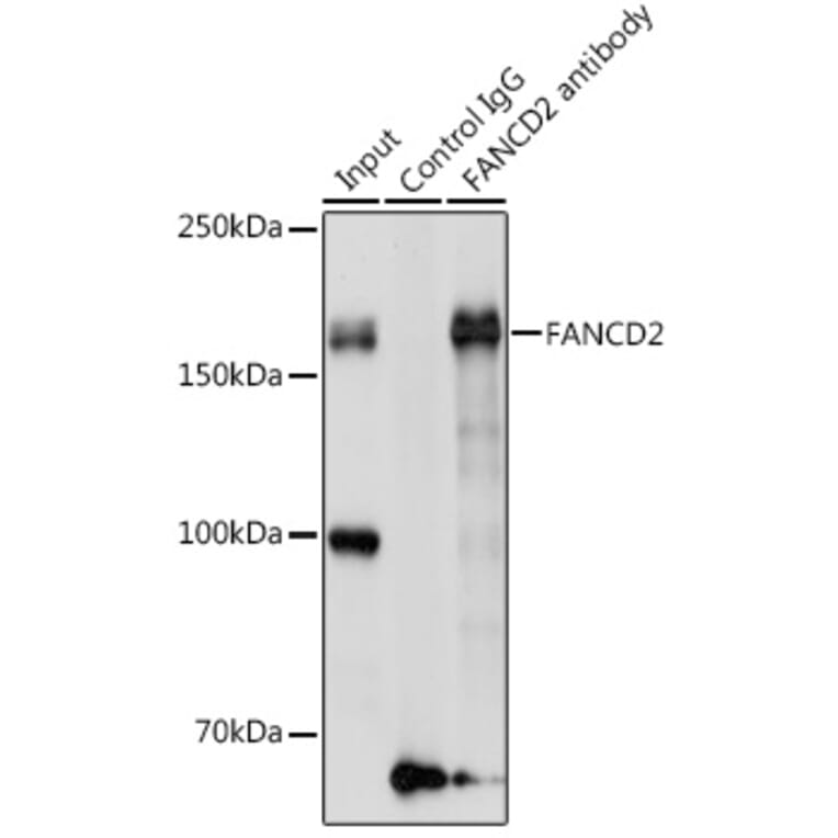 Western Blot - Anti-FANCD2 Antibody (A13848) - Antibodies.com