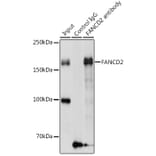 Western Blot - Anti-FANCD2 Antibody (A13848) - Antibodies.com