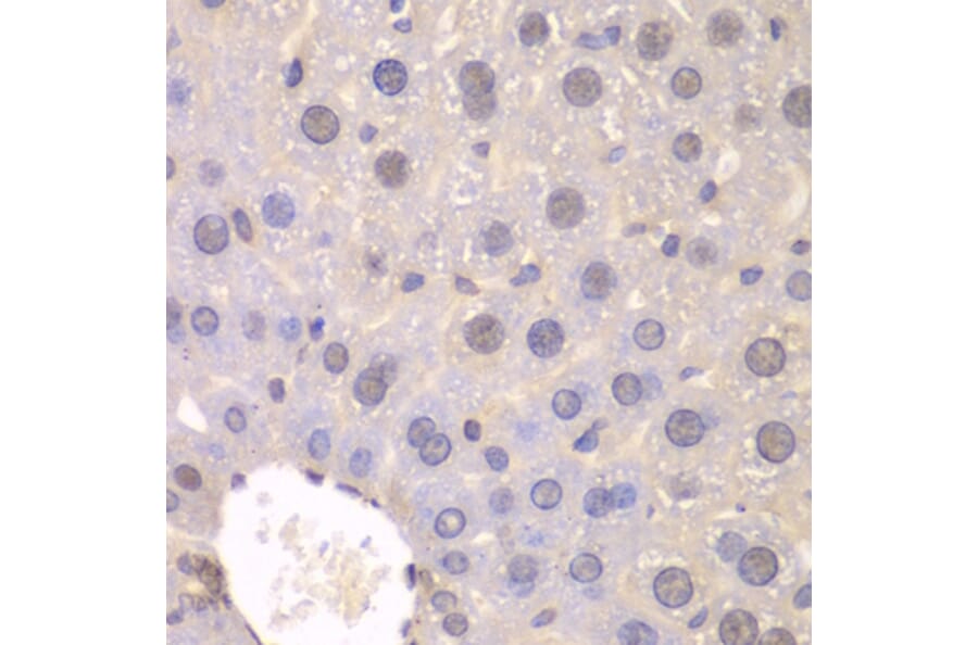 Immunohistochemistry - Anti-FGFR1 Antibody (A2073) - Antibodies.com