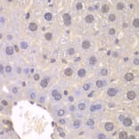 Immunohistochemistry - Anti-FGFR1 Antibody (A2073) - Antibodies.com