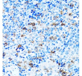 Immunohistochemistry - Anti-FGFR2 Antibody (A13850) - Antibodies.com