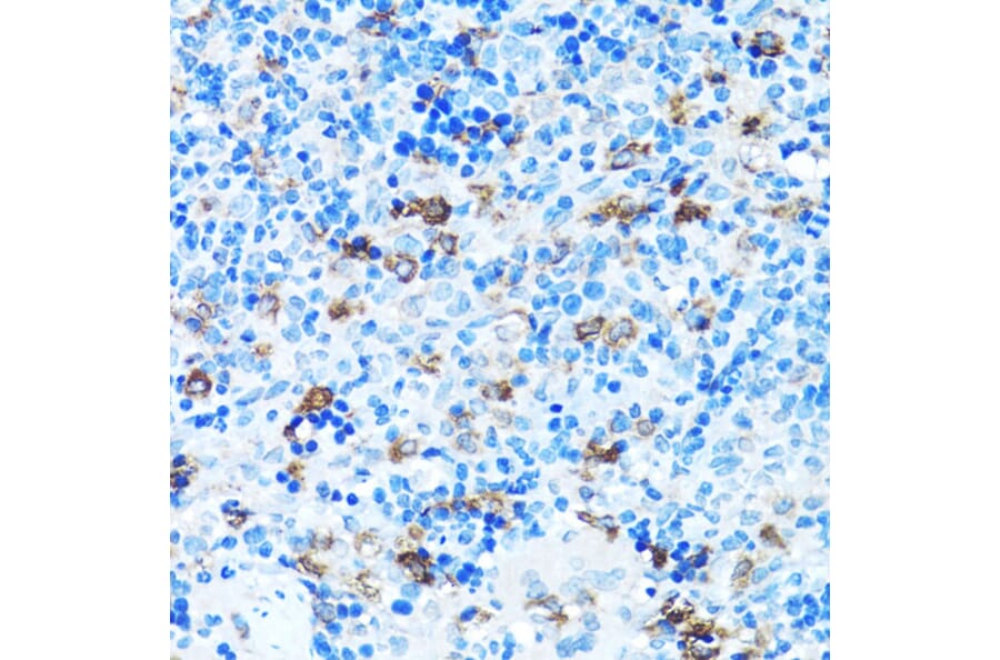 Immunohistochemistry - Anti-FGFR2 Antibody (A13850) - Antibodies.com