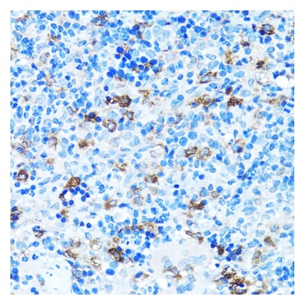 Immunohistochemistry - Anti-FGFR2 Antibody (A13850) - Antibodies.com