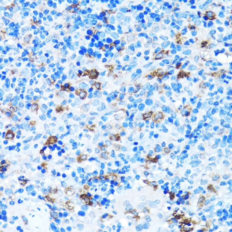Immunohistochemistry - Anti-FGFR2 Antibody (A13850) - Antibodies.com