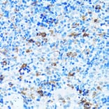 Immunohistochemistry - Anti-FGFR2 Antibody (A13850) - Antibodies.com
