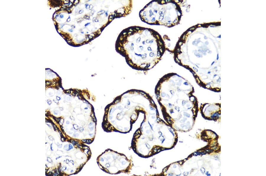 Immunohistochemistry - Anti-FGFR2 Antibody (A13850) - Antibodies.com