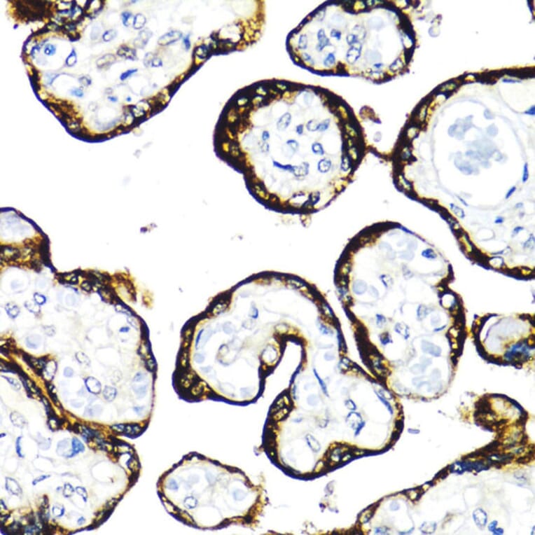 Immunohistochemistry - Anti-FGFR2 Antibody (A13850) - Antibodies.com