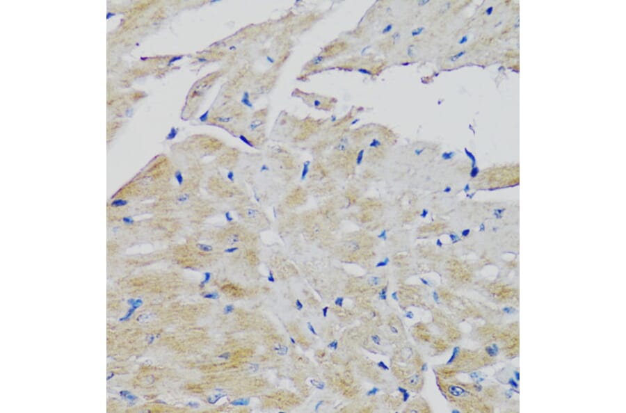 Immunohistochemistry - Anti-FGFR2 Antibody (A13850) - Antibodies.com