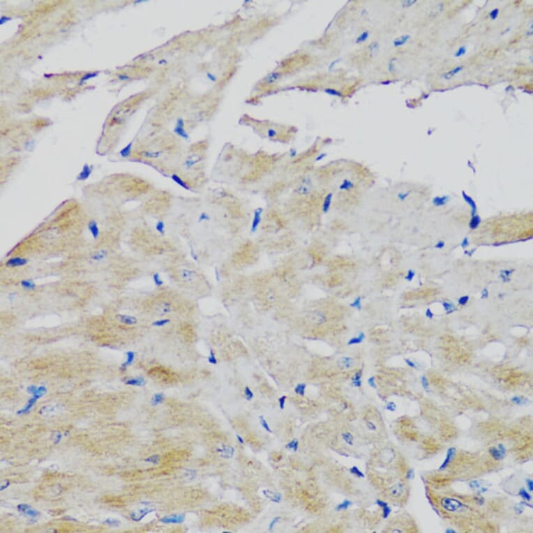 Immunohistochemistry - Anti-FGFR2 Antibody (A13850) - Antibodies.com