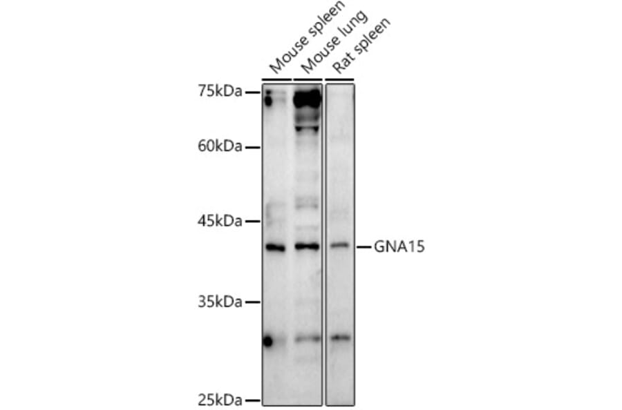 Western Blot - Anti-GNA15 Antibody (A13851) - Antibodies.com