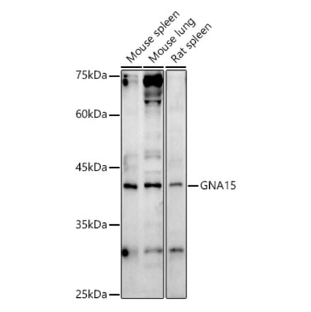 Western Blot - Anti-GNA15 Antibody (A13851) - Antibodies.com