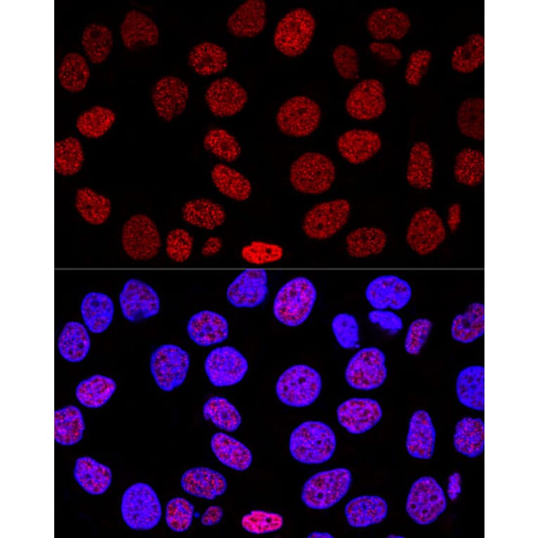 Immunofluorescence - Anti-Histone H2A.X Antibody (A13852) - Antibodies.com